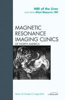 MRI of the Liver, an Issue of Magnetic Resonance Imaging Clinics, 18 1437726917 Book Cover