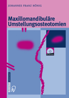 Maxillomandibulare Umstellungsosteotomien 364263284X Book Cover