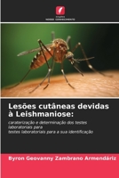 Lesões cutâneas devidas à Leishmaniose:: caraterização e determinação dos testes laboratoriais paratestes laboratoriais para a sua identificação B0CKKSPS7R Book Cover