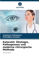 Katarakt: Ätiologie, Pathogenese und moderne chirurgische Methode (German Edition) 6208548438 Book Cover