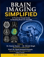 BRAIN IMAGING SIMPLIFIED: A Practical Visual Guide to Reading Brain CT and MRI (Doctor Clinical Series) B0HHN59R9F Book Cover