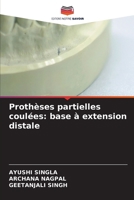 Prothèses partielles coulées: base à extension distale (French Edition) 6630331397 Book Cover