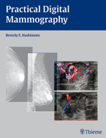 Practical Digital Mammography 3131480416 Book Cover