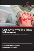 Calkowita wymiana stawu kolanowego (Polish Edition) 620988797X Book Cover