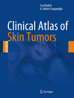 Clinical Atlas of Skin Tumors 3642409377 Book Cover
