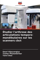 Étudier l'arthrose des articulations temporo-mandibulaires sur les scanners cbct (French Edition) 6207027418 Book Cover