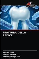 Frattura Della Radice 6203350540 Book Cover