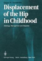 Displacement of the Hip in Childhood: Aetiology, Management and Sequelae 1447113136 Book Cover