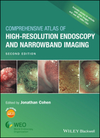 Comprehensive Atlas of High Resolution Endoscopy and Narrowband Imaging 1405158867 Book Cover