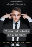 Caída del Cabello en el Hombre B0CHXJ187Q Book Cover