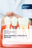 Basal Implants - a New Era in Dentistry 6138948351 Book Cover