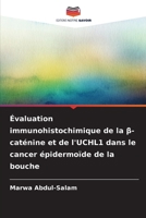 Évaluation immunohistochimique de la β-caténine et de l'UCHL1 dans le cancer épidermoïde de la bouche 6209409156 Book Cover