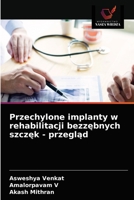 Przechylone implanty w rehabilitacji bezzębnych szczęk - przegląd 6203617091 Book Cover