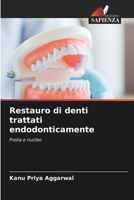 Restauro di denti trattati endodonticamente: Posta e nucleo (Italian Edition) B0CL617FZG Book Cover
