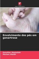 Envolvimento dos p�s em gonartrose 620411655X Book Cover