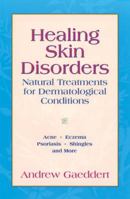 Healing Skin Disorders: Natural Treatments for Dermatological Conditions 1556434529 Book Cover