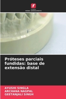 Próteses parciais fundidas: base de extensão distal (Portuguese Edition) 6630254600 Book Cover