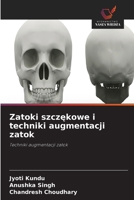 Zatoki szczekowe i techniki augmentacji zatok (Polish Edition) 6630192664 Book Cover