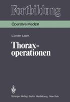 Thoraxoperationen 3540106014 Book Cover