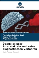 Überblick über Prostatakrebs und seine diagnostischen Verfahren (German Edition) 6208855837 Book Cover