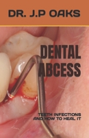 DENTAL ABCESS: TEETH INFECTIONS AND HOW TO HEAL IT B0C8RBK7W1 Book Cover