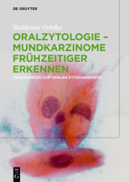Oralzytologie - Mundkarzinome Fr�hzeitiger Erkennen: Praxiswissen Zur Oralen Zytodiagnostik 3110627507 Book Cover