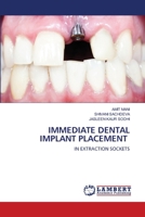 IMMEDIATE DENTAL IMPLANT PLACEMENT: IN EXTRACTION SOCKETS 6203202843 Book Cover