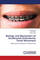 Biology and Biomarkers of Accelerated Orthodontic Tooth Movement: Reducing the orthodontic treatment time 6205633515 Book Cover