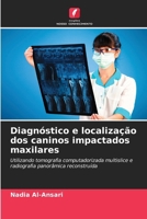 Diagnóstico e localização dos caninos impactados maxilares (Portuguese Edition) 6208938791 Book Cover