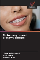 Nadmierny wzrost pionowy szczęki 6630168763 Book Cover