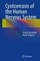 Cysticercosis of the Human Nervous System 3642390218 Book Cover