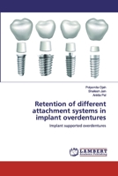 Retention of different attachment systems in implant overdentures 620047429X Book Cover