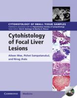 Cytohistology of Focal Liver Lesions 110702417X Book Cover