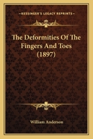 The Deformities of the Fingers and Toes (Classic Reprint) 1166963861 Book Cover