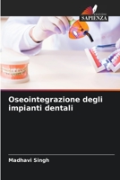 Oseointegrazione degli impianti dentali 6205253518 Book Cover