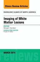 Imaging of White Matter, an Issue of Radiologic Clinics of North America: Volume 52-2 0323287204 Book Cover