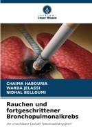 Rauchen und fortgeschrittener Bronchopulmonalkrebs 6630184181 Book Cover