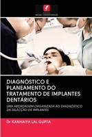 Diagnosi E Pianificazione del Trattamento Dell'impianto Dentale 6202851880 Book Cover