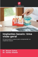 Implantes basais: Uma visão geral (Portuguese Edition) 6208463297 Book Cover
