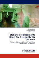 Total knee replacement: Boon for Osteoarthritis patients 3659192570 Book Cover