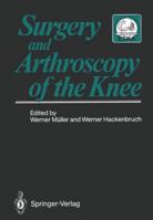 Surgery and Arthroscopy of the Knee: Second European Congress of Knee Surgery and Arthroscopy Basel, Switzerland, 29.Sept.-4.Oct.1986 3540179828 Book Cover