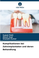 Komplikationen bei Zahnimplantaten und deren Behandlung (German Edition) 6207225570 Book Cover