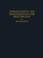 Thoraxschnitte Von Erkrankungen Der Brustorgane: Ein Atlas 3662392011 Book Cover