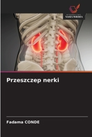 Przeszczep nerki (Polish Edition) 6202030577 Book Cover