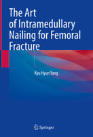 The Art of Intramedullary Nailing for Femoral Fracture 981193729X Book Cover