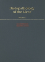Histopathology of the Liver: 2 Volume Set 0195043936 Book Cover