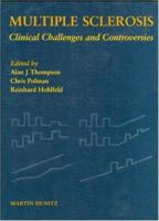 Multiple Sclerosis: Clinical Challenges and Controversies 1853174289 Book Cover