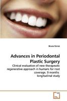 Advances in Periodontal Plastic Surgery: Clinical evaluation of new therapeutic regenerative approach in humans for root coverage. 9 months longitudinal study 3639229592 Book Cover