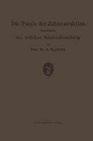Die Praxis Der Zahnextraktion, Einschliesslich Der Ortlichen Schmerzbetaubung: Kurzgefasstes Lehrbuch Fur Zahnarzte, Arzte Und Studierende 3662298600 Book Cover