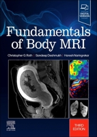 Fundamentals of Body MRI 141605183X Book Cover